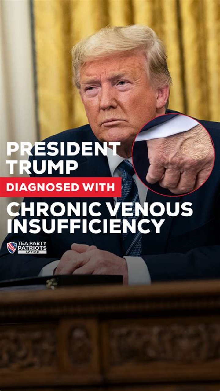 Barron Trump's Medical Condition: A Comprehensive Guide