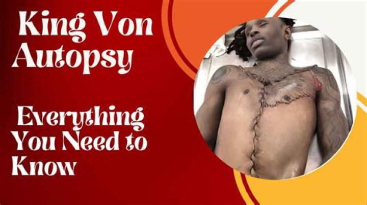 Exclusive: Leaked Autopsy Reveals King Von's Cause Of Death