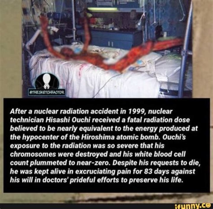 Hisashi Ouchi: The Tragic Aftermath Of A Nuclear Accident