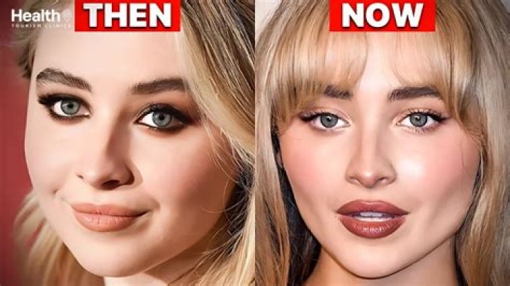 Sabrina Carpenter's Plastic Surgery Journey: A Before And After Transformation