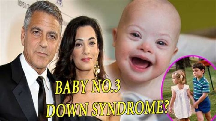 The Clooney Twins: Understanding Down Syndrome