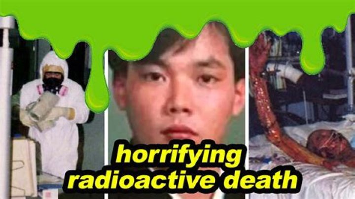 The Harrowing Images Of Hisashi Ouchi: Unraveling The Tragic Consequences Of Radiation Exposure