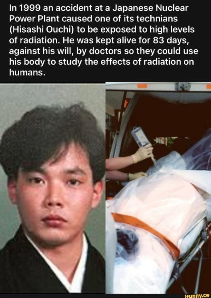 The Remarkable Body Of Hisashi Ouchi: A Case Study Of Radiation Resistance
