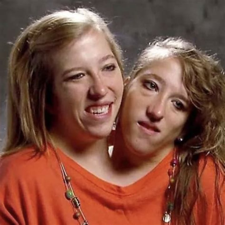 Top Pictures Of Abby And Brittany Hensel