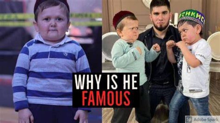 Understanding Hasbulla Syndrome: A Deep Dive Into The Phenomenon