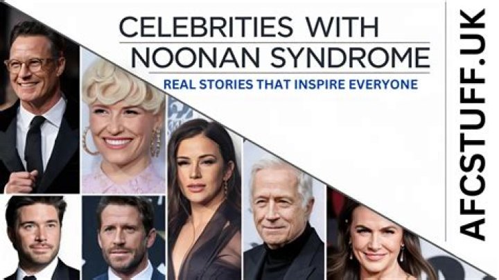Unveiling The Inspiring World Of Celebrities With Noonan Syndrome