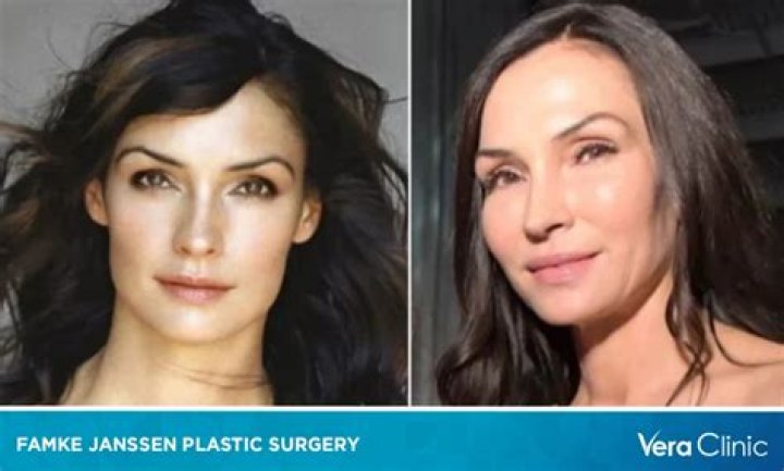 Unveiling The Mystery Behind The Plastic Famke Janssen Face