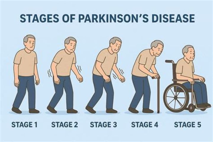 Unveiling The Parkinson's Journey Of Richard Dreyfuss: Discoveries And Insights